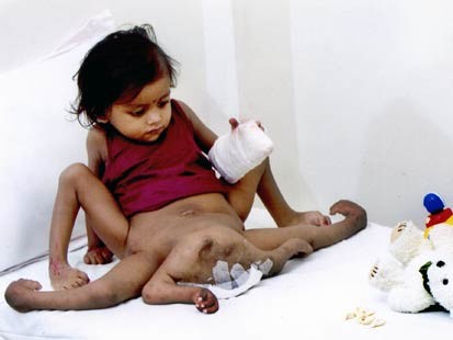 Dea bambina Plastik Ultrabellezza