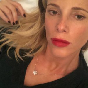 foto Alessia Marcuzzi figlia caduta sbatte la testa