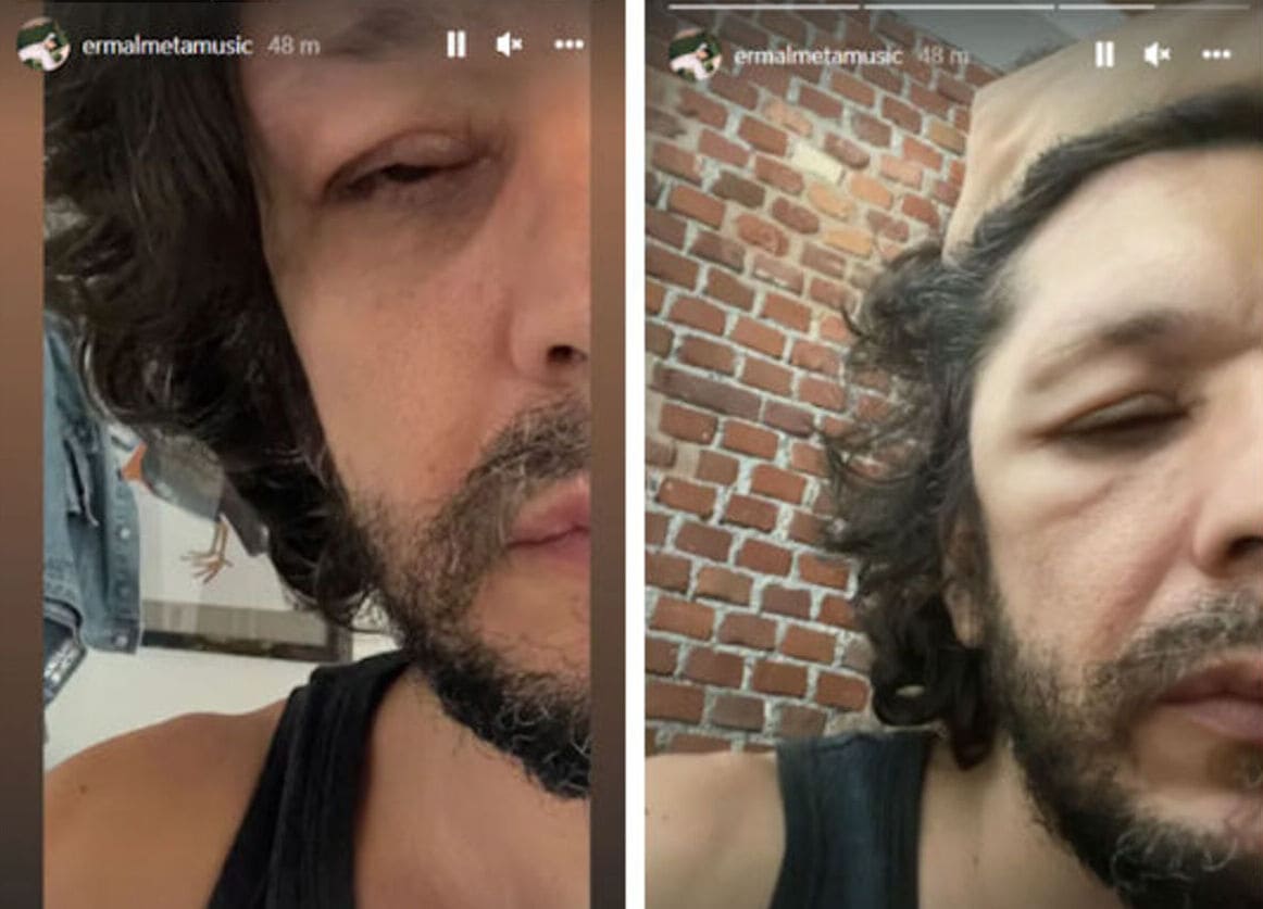 foto salute erma meta