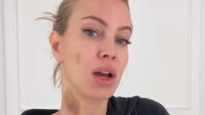 Foto Taylor Mega ematomi