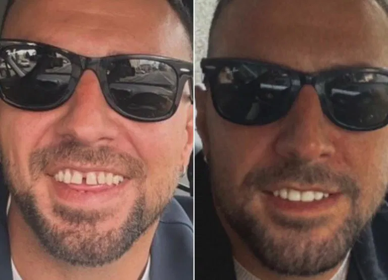 Antonio Panico denti 