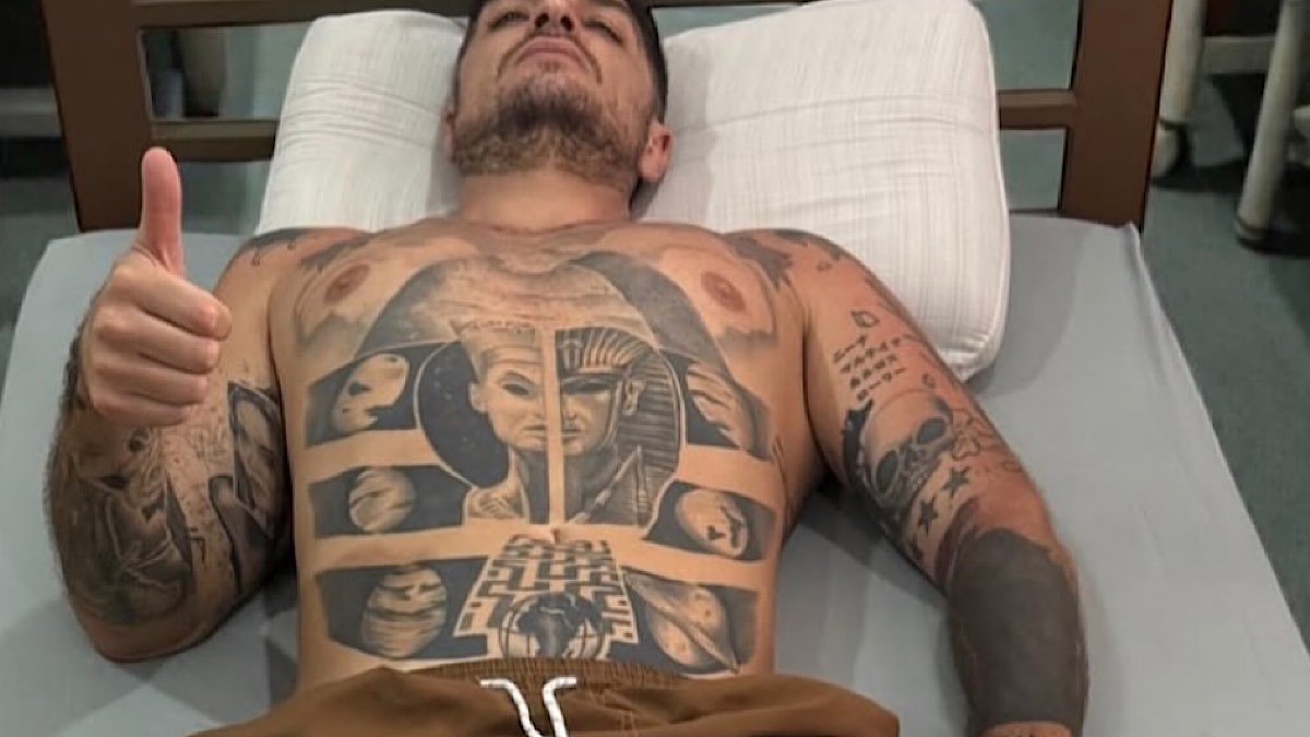 Foto Luigi Favoloso morso serpente