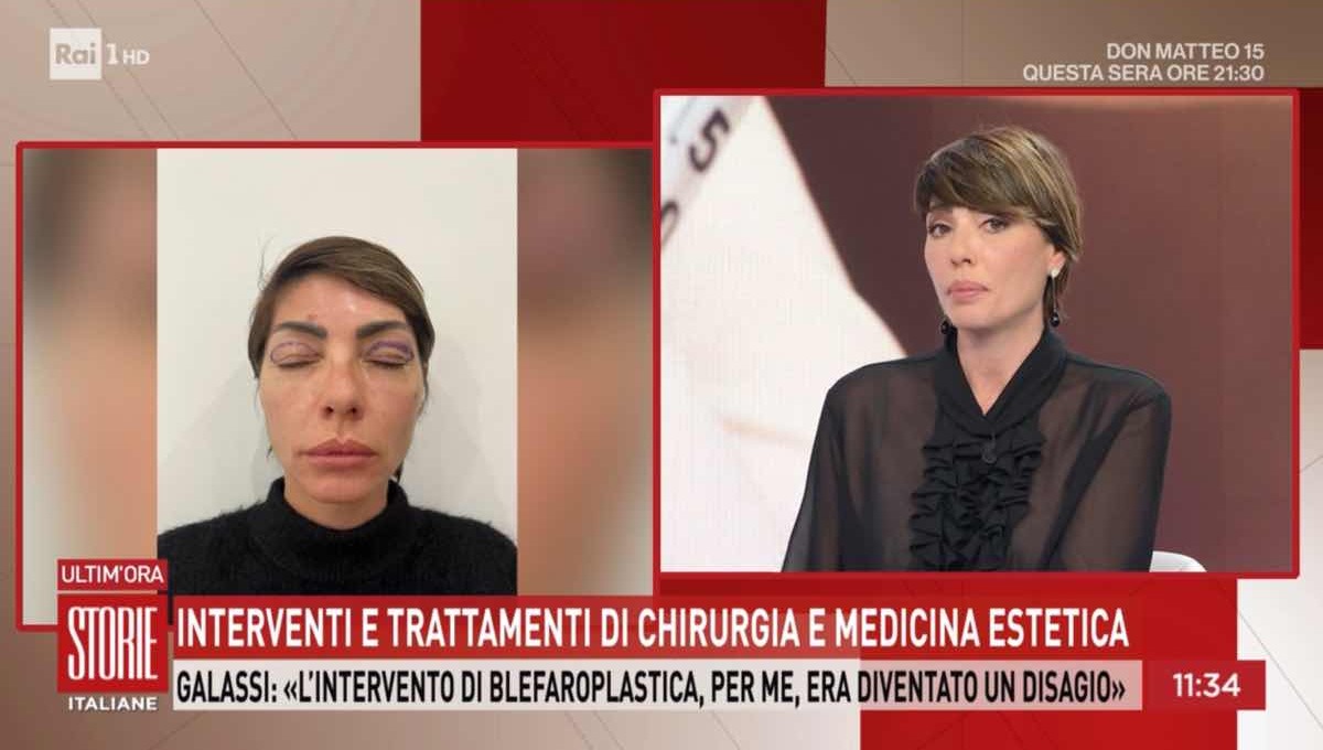 foto intervento galassi