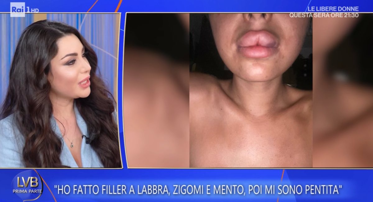 foto jenny temptation island chirurgia 