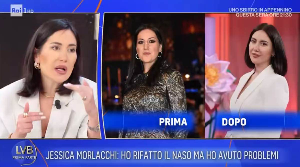 foto jessica morlacchi prima dopo ritocchi