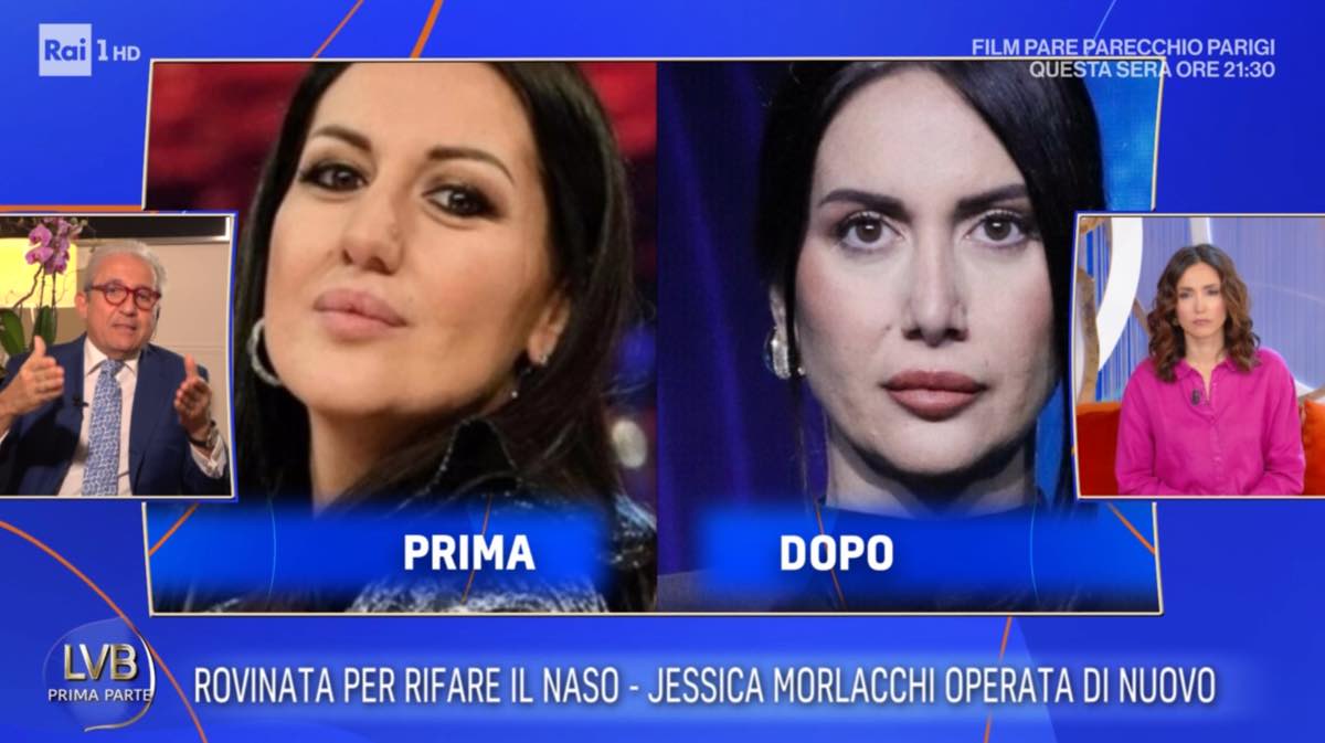 foto naso jessica morlacchi prima dopo