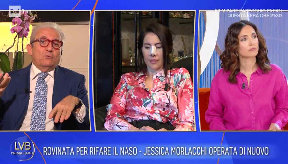 foto operazione naso jessica morlacchi