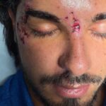 Temptation Island, incidente per Marco Fatata (single di Francesca): come sta