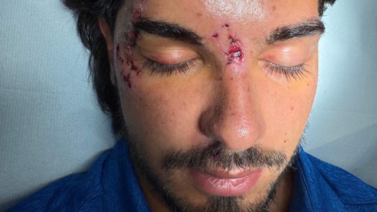 foto marco fatata incidente temptation island