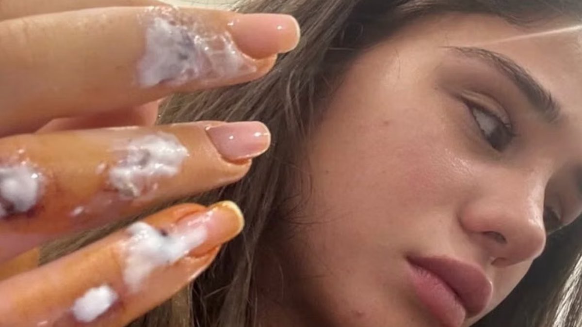Foto Cristiana Anania incidente
